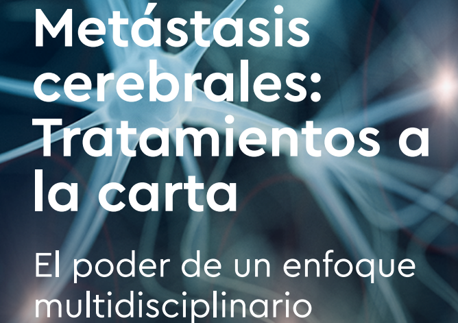 Webinar | Metástasis cerebrales: el poder de un enfoque multidisciplinario